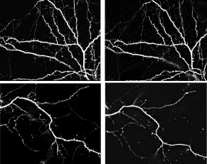 Four images used in Dendritic Spines Lab lesson