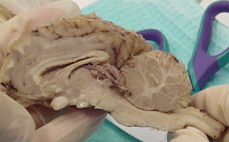 Sheep brain